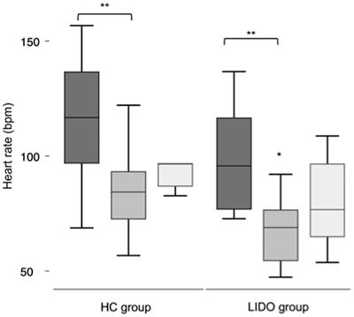 Lidocaine constant rate infusion in isoflurane anesthetized neonatal foals